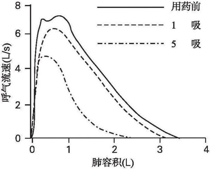 第二節 支氣管激發試驗